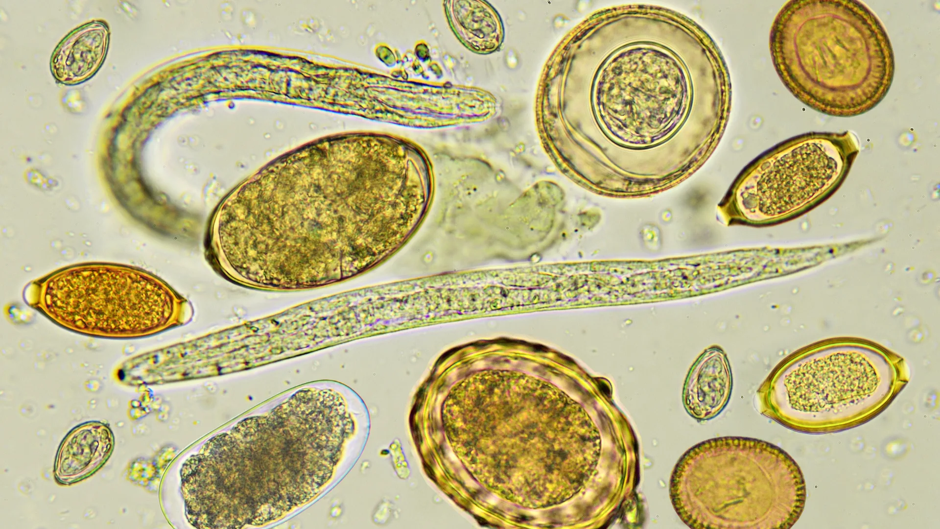 Stool Parasite Test
